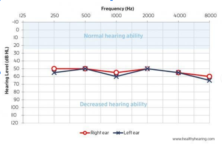 Hearing Aid Results Fairfax Hearing Center