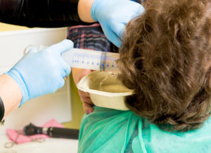 ear wax removal in Falls Church VA